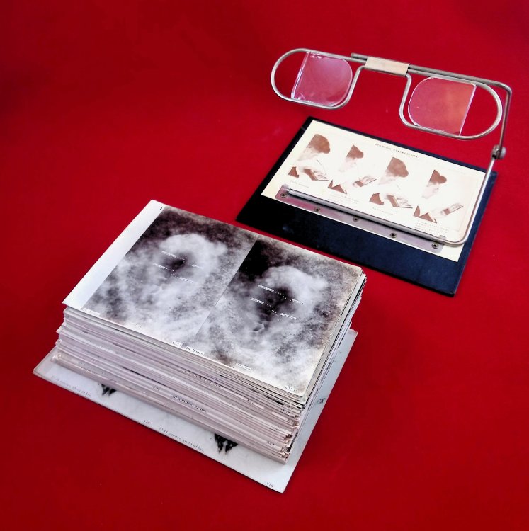 A Stereoscopic Atlas of the Chick