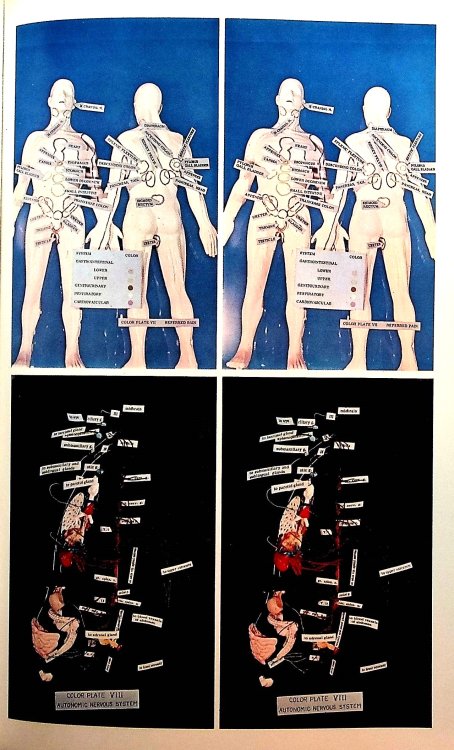 Anatomy for the Anesthesiologist: A Stereoscopic Atlas