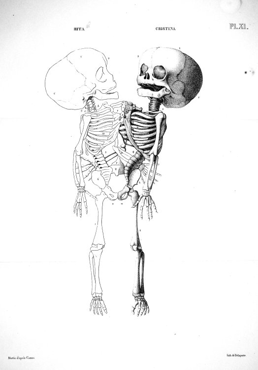 Recherces d'Anatomie Transcendante et Pathologique: Theorie des Formations et des Deformations Organiques, Appliquee a l'Anatomie de Ritta Christina, et de la Duplicite Monstrueuse [Research in Transcendent and Pathological Anatomy: Theory of Organic Formations and Deformations, Applied to the Anato