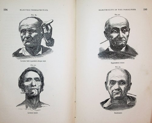 Medical Electricity: A Practical Treatise on the Applications of Electricity to Medicine and Surgery