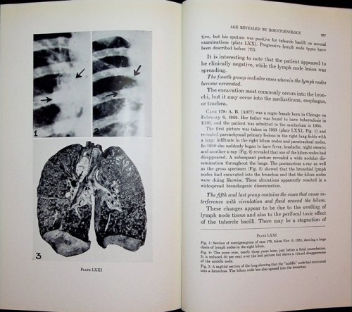 Age Morphology of Primary Tubercles