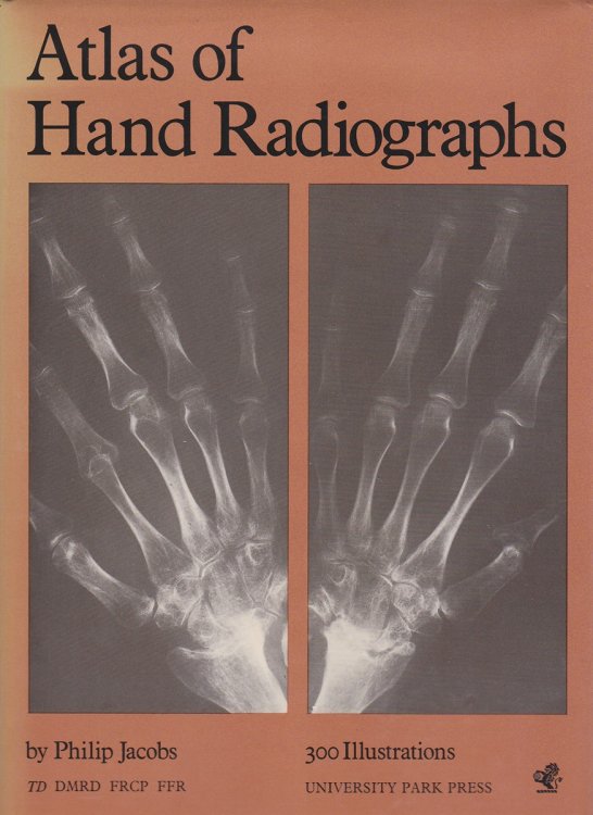 ATLAS OF HAND RADIOGRAPHS