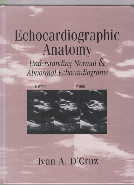 Image for ECHOCARDIOGRAPHIC ANATOMY Understanding Normal and Abnormal Echocardiograms ECHOCARDIOGRAPHIC ANATOMY Understanding Normal and Abnormal Echocardiograms
