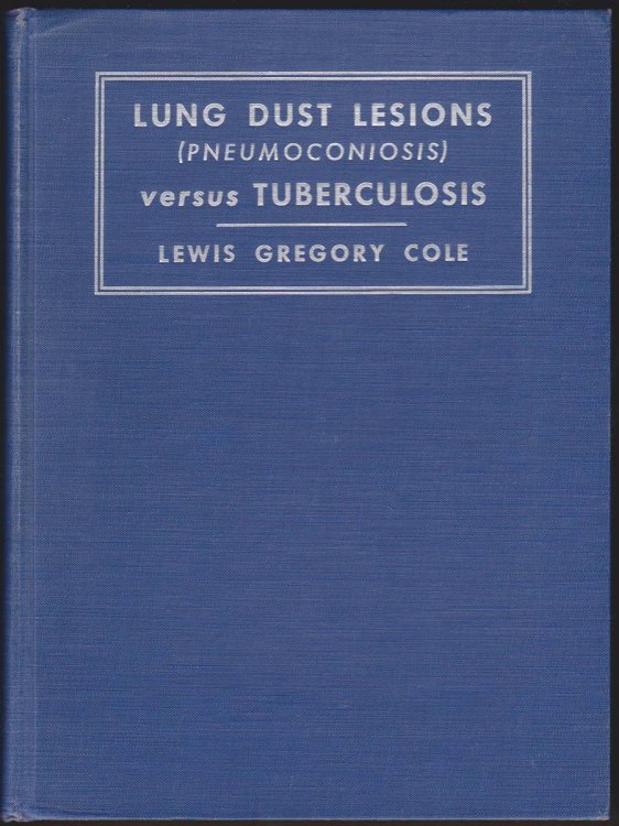 LUNG DUST LESIONS VERSUS TUBERCULOSIS