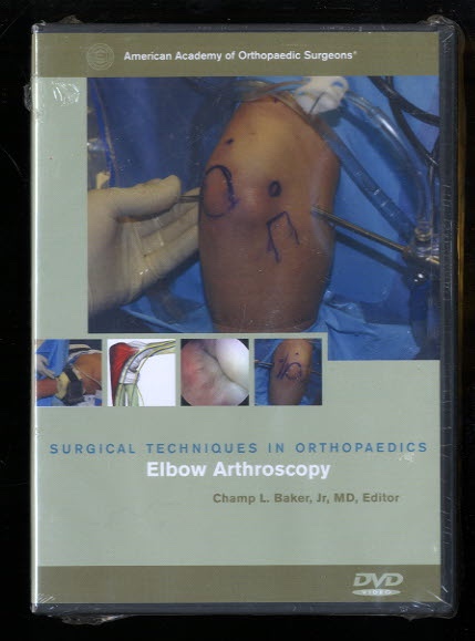 Elbow Arthroscopy