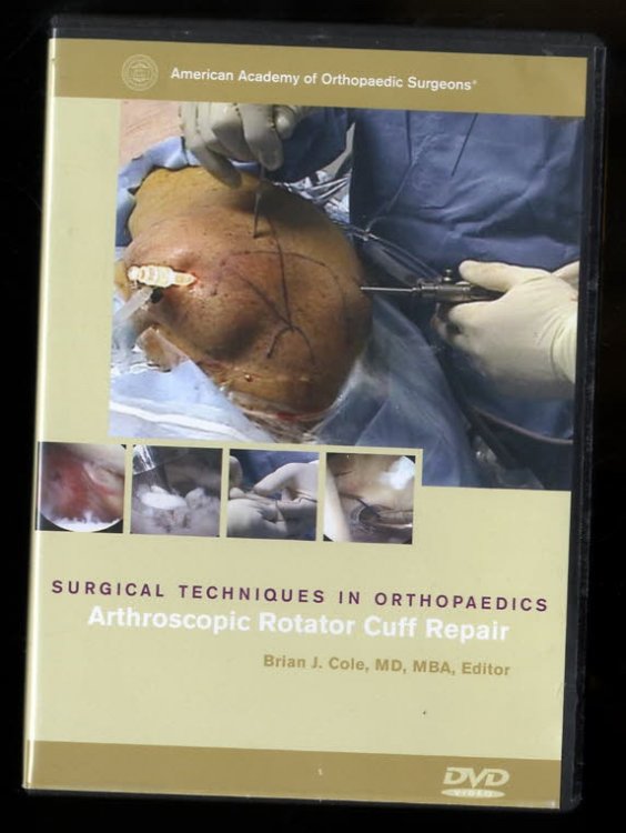 Arthroscopic Rotator Cuff Repair